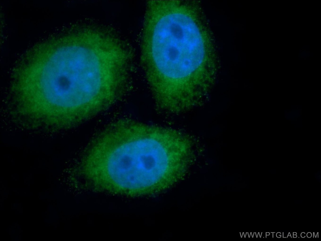 PIWIL1 Polyclonal antibody
