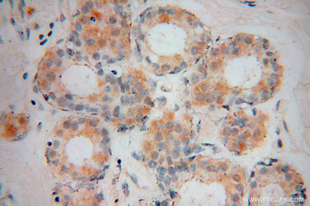 VPS25 Polyclonal antibody