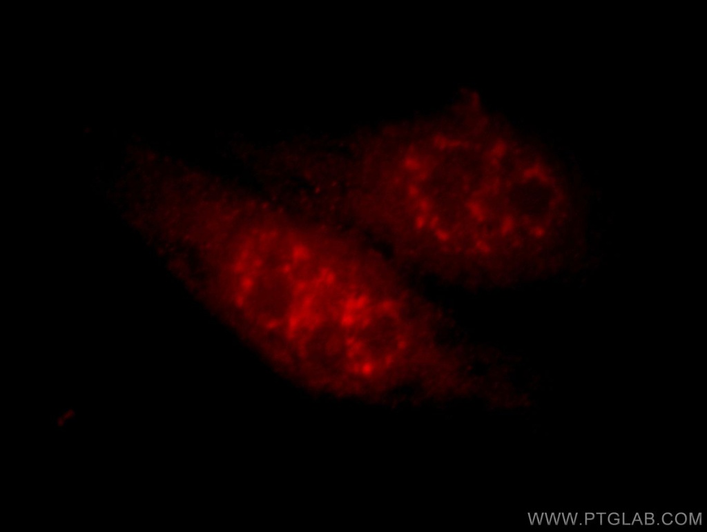 HEYL Polyclonal antibody