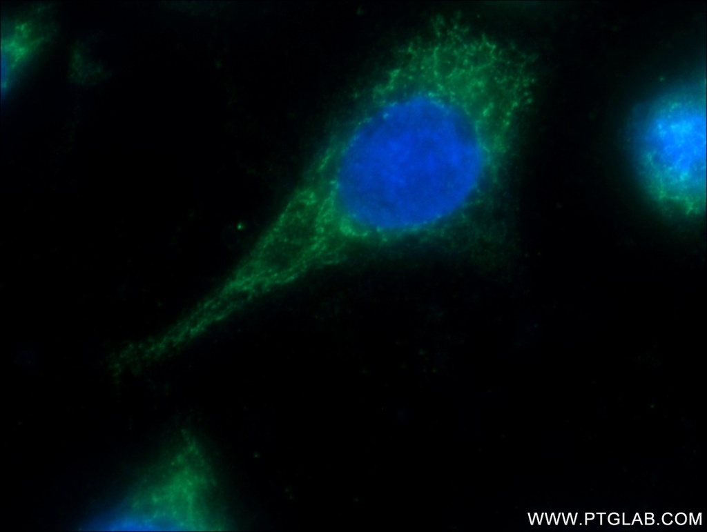 MRPL45 Polyclonal antibody