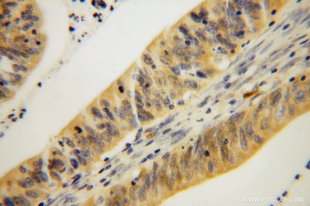 GMPR 1/2 Polyclonal antibody