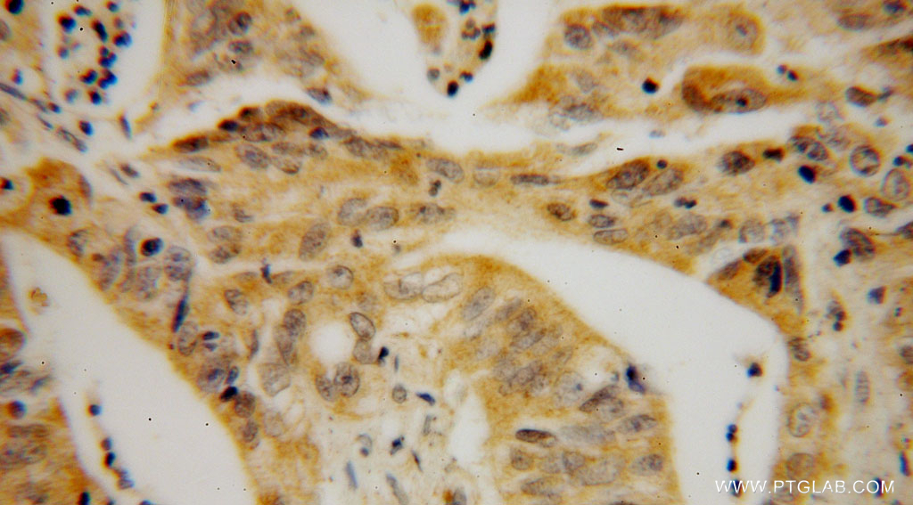 STARD7 Polyclonal antibody