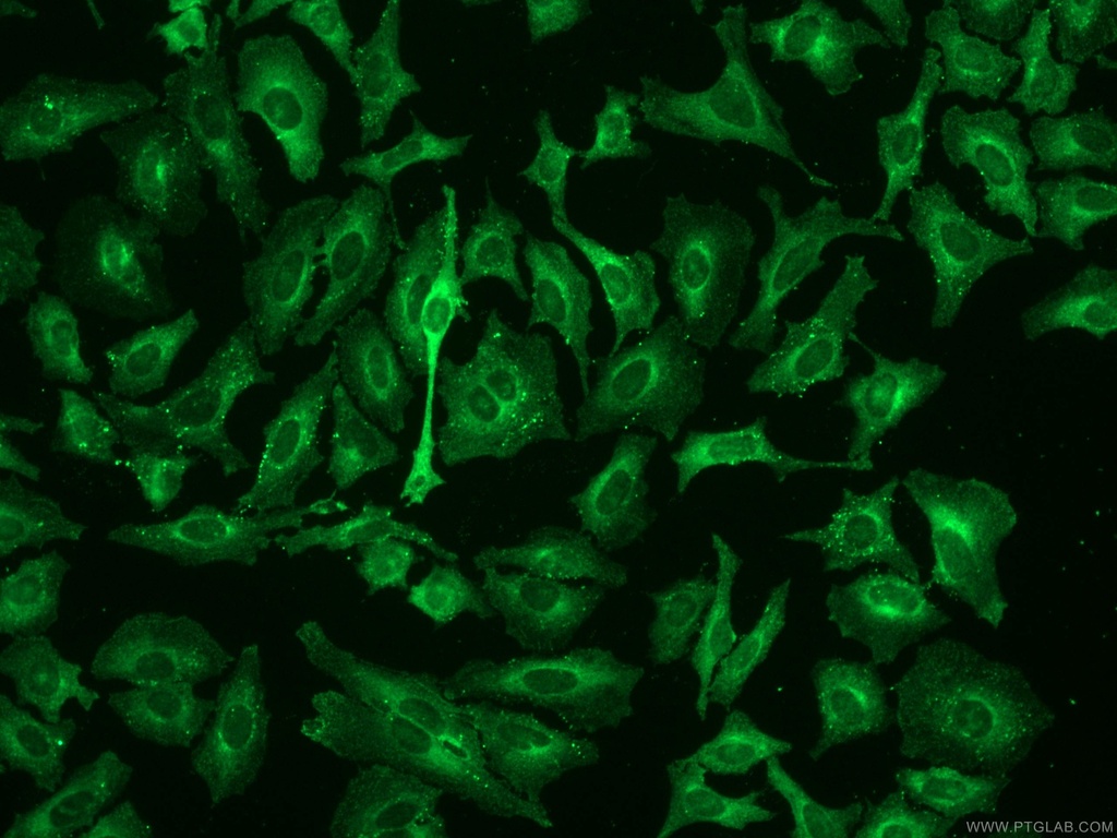 AP2B1 Polyclonal antibody