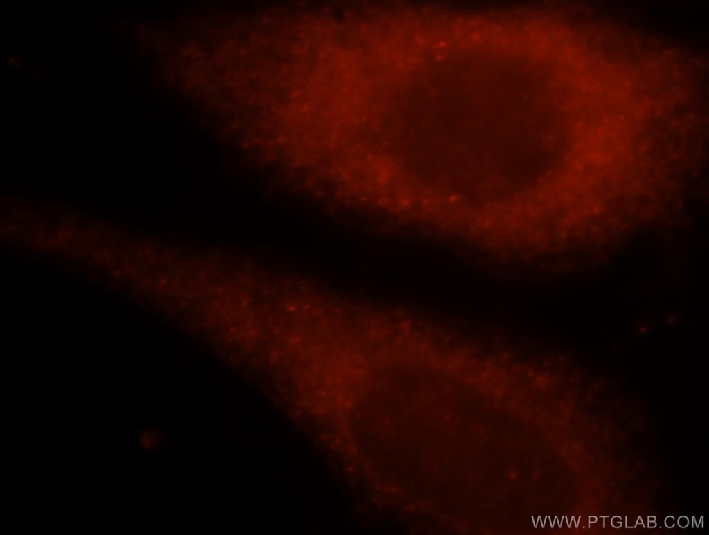 TK1 Polyclonal antibody