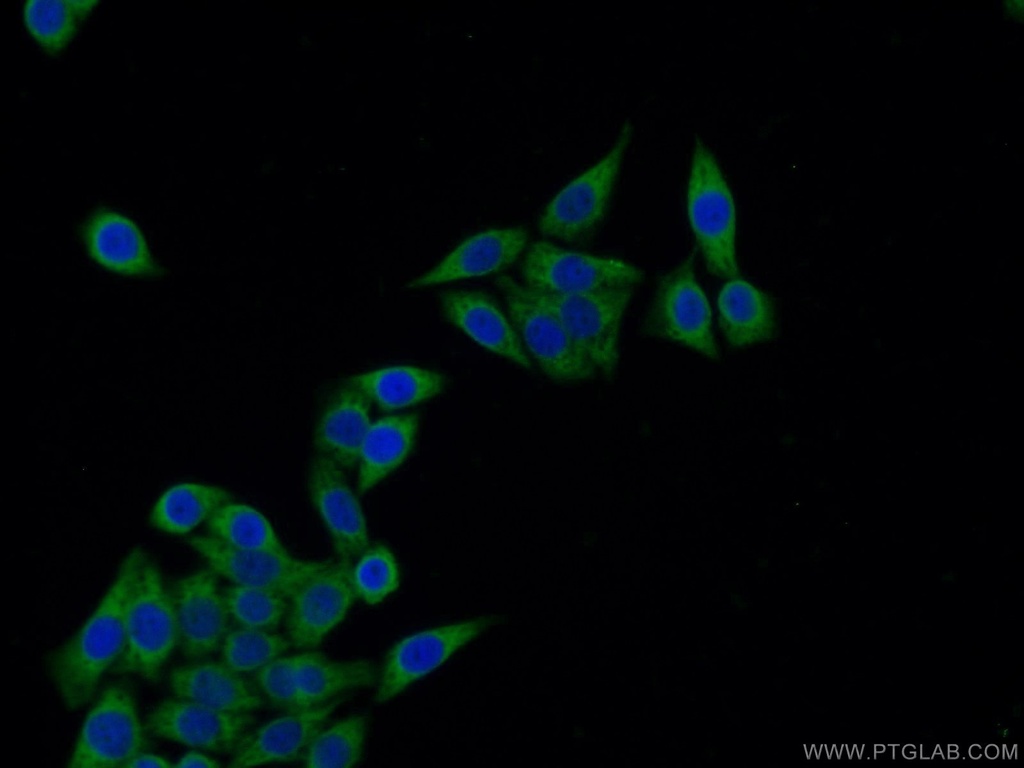 IGFBP2 Polyclonal antibody