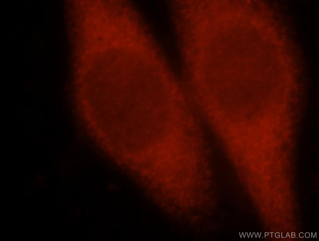 PCBD1 Polyclonal antibody