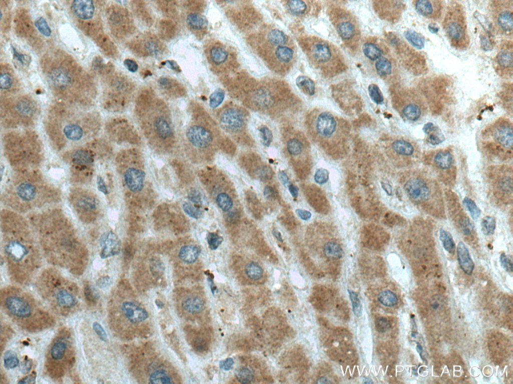 L2HGDH Polyclonal antibody