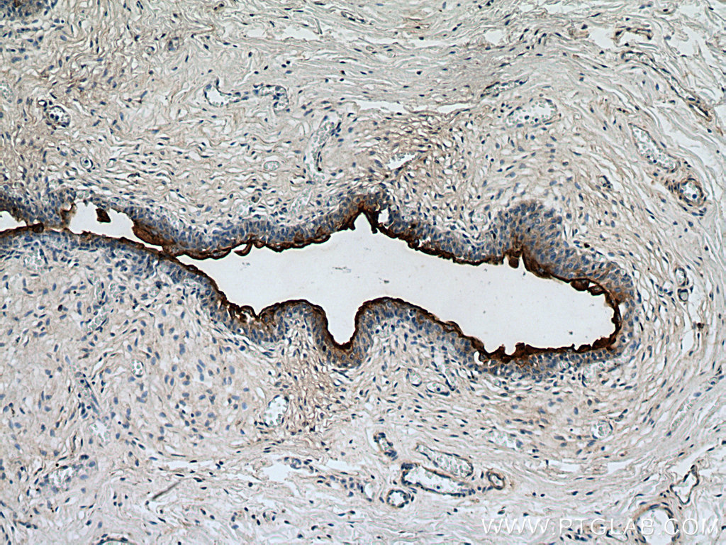 UPK3B Polyclonal antibody
