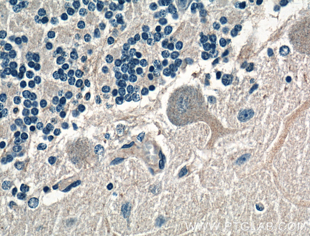 AMPD2 Polyclonal antibody