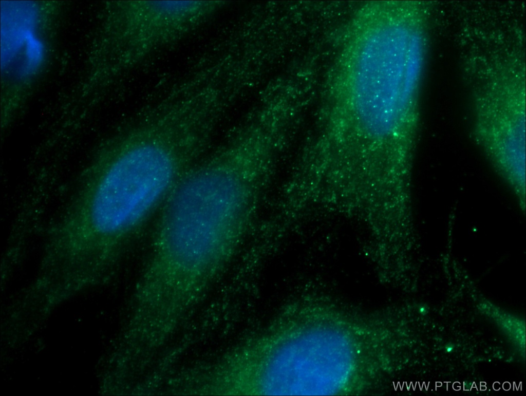 GSS Polyclonal antibody