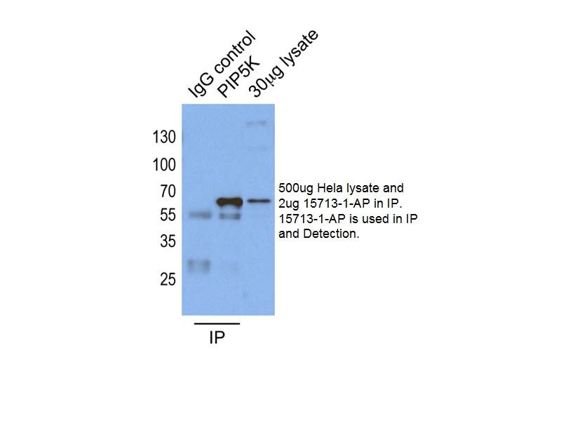 PIP5K1A Polyclonal antibody