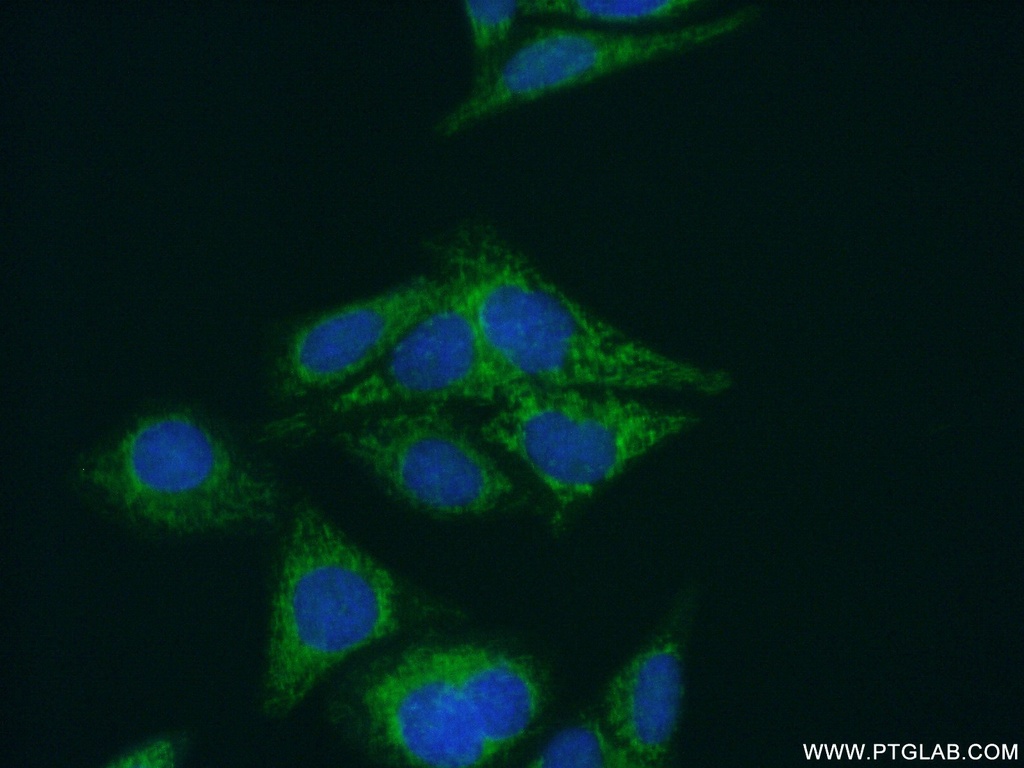 NARS2 Polyclonal antibody