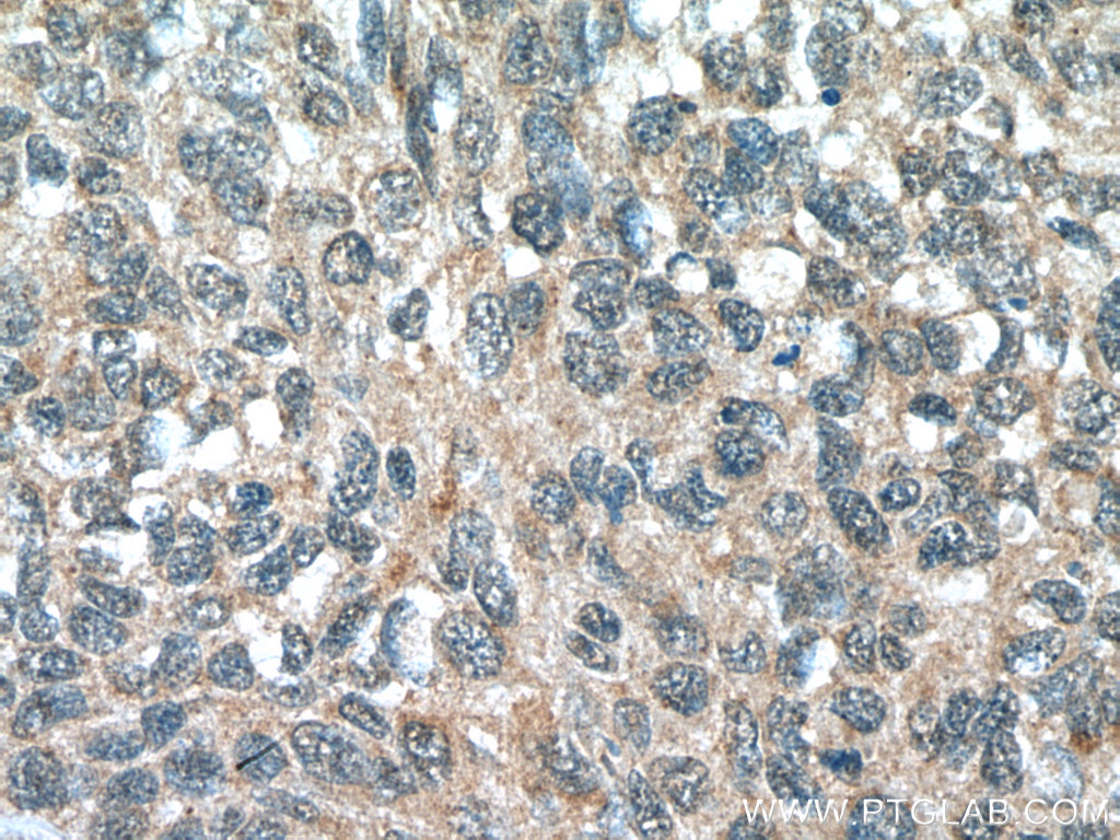 FMO2 Polyclonal antibody