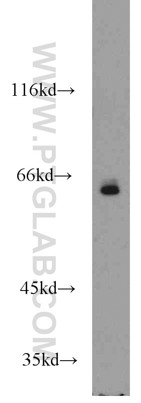 TAF6L Polyclonal antibody