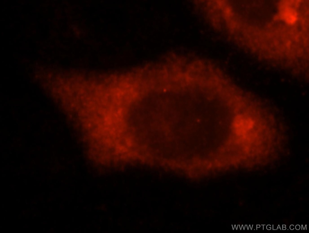 SLC7A4 Polyclonal antibody
