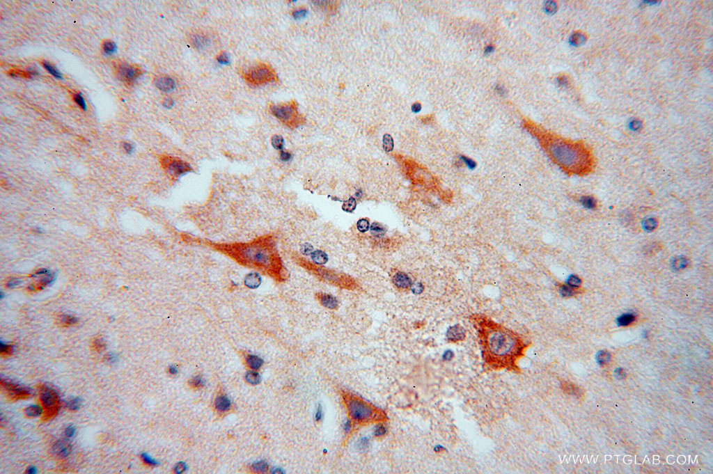 RPL18A Polyclonal antibody