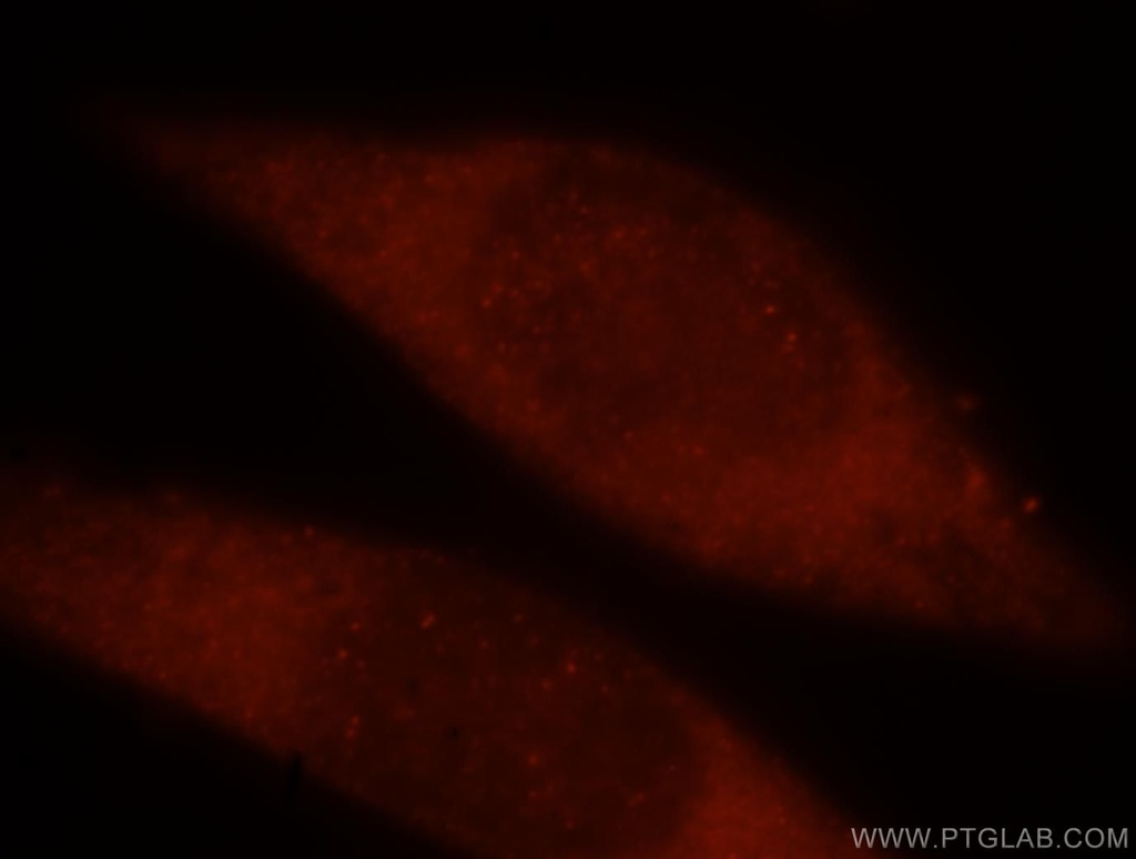 TRBP Polyclonal antibody