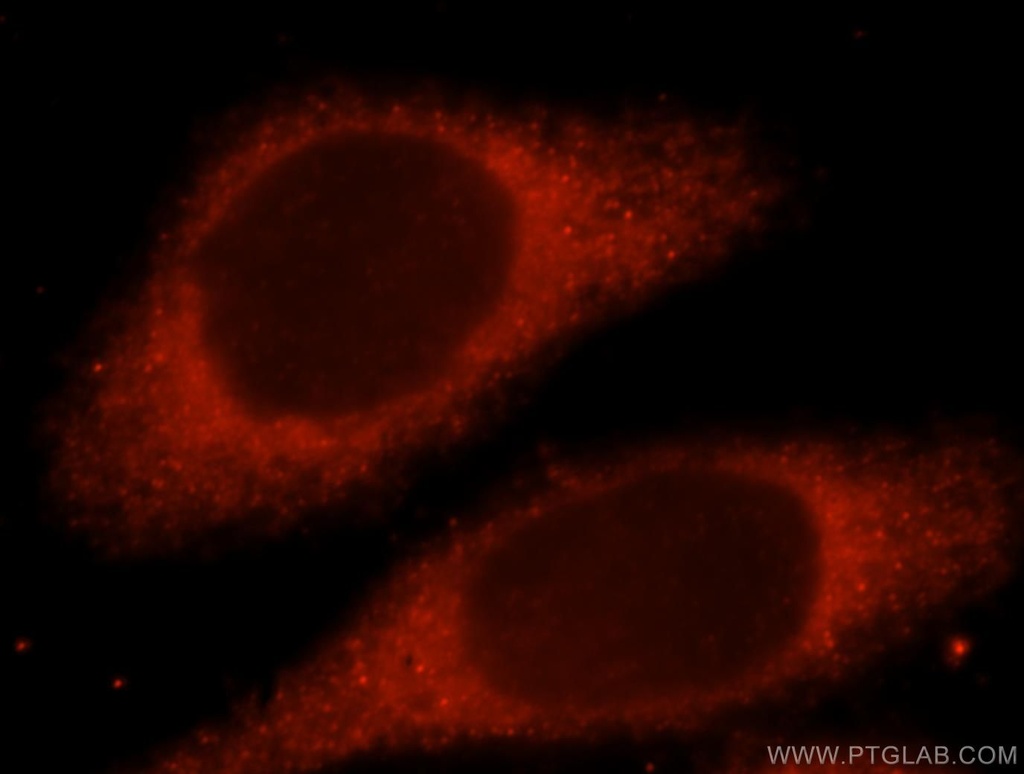 LHPP Polyclonal antibody