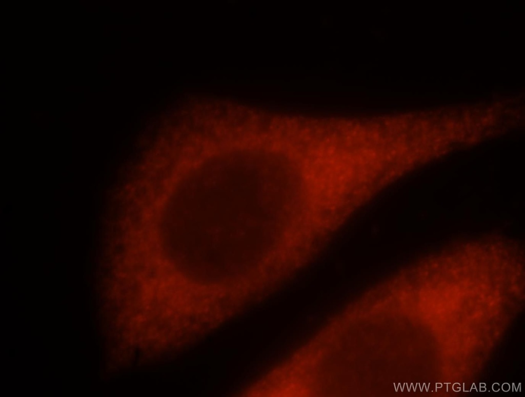NQO2 Polyclonal antibody