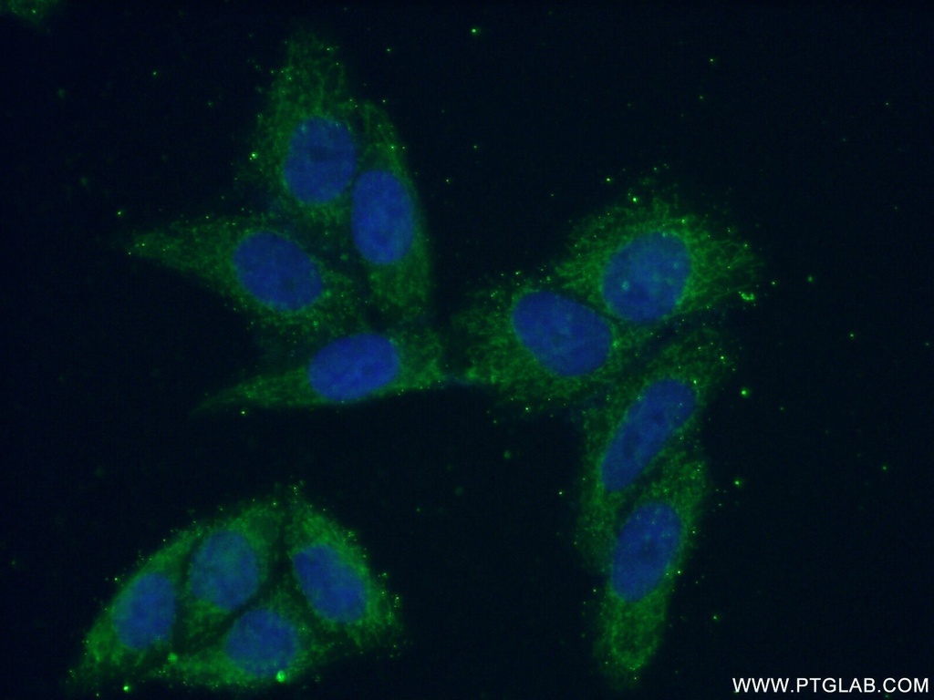 VARS2 Polyclonal antibody