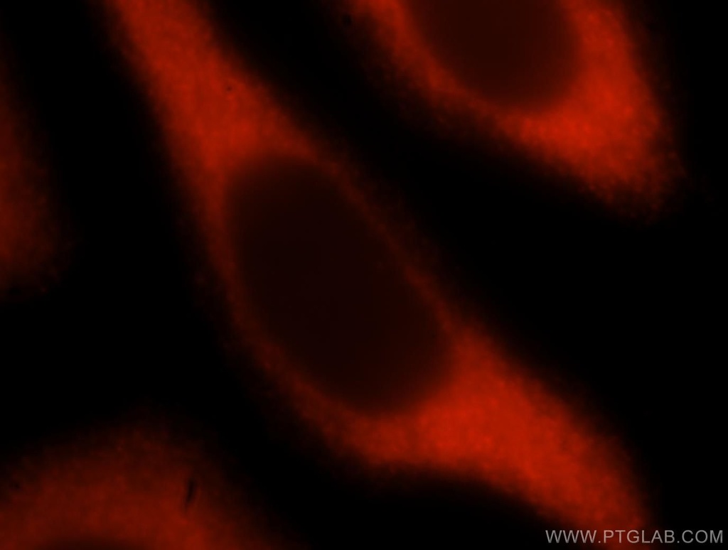 TBCB Polyclonal antibody