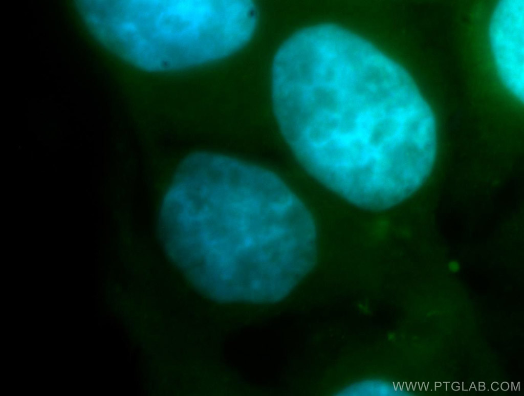 RBM41 Polyclonal antibody