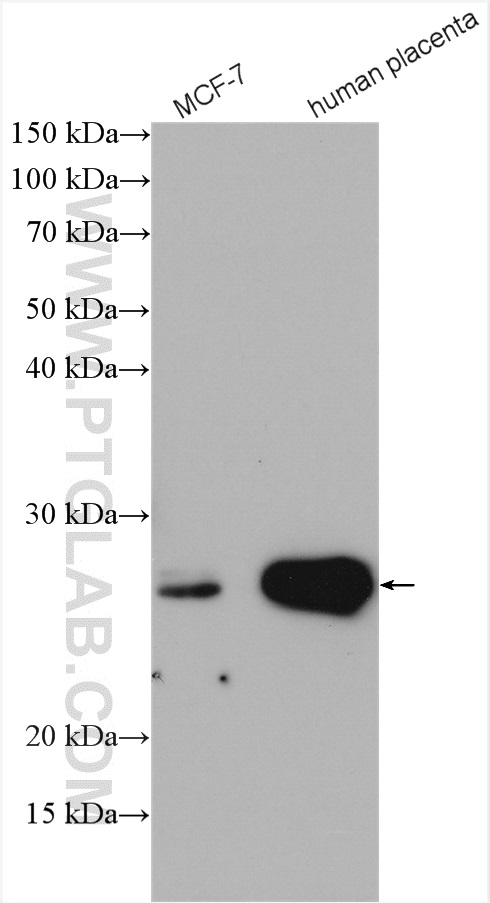 Grancalcin Polyclonal antibody