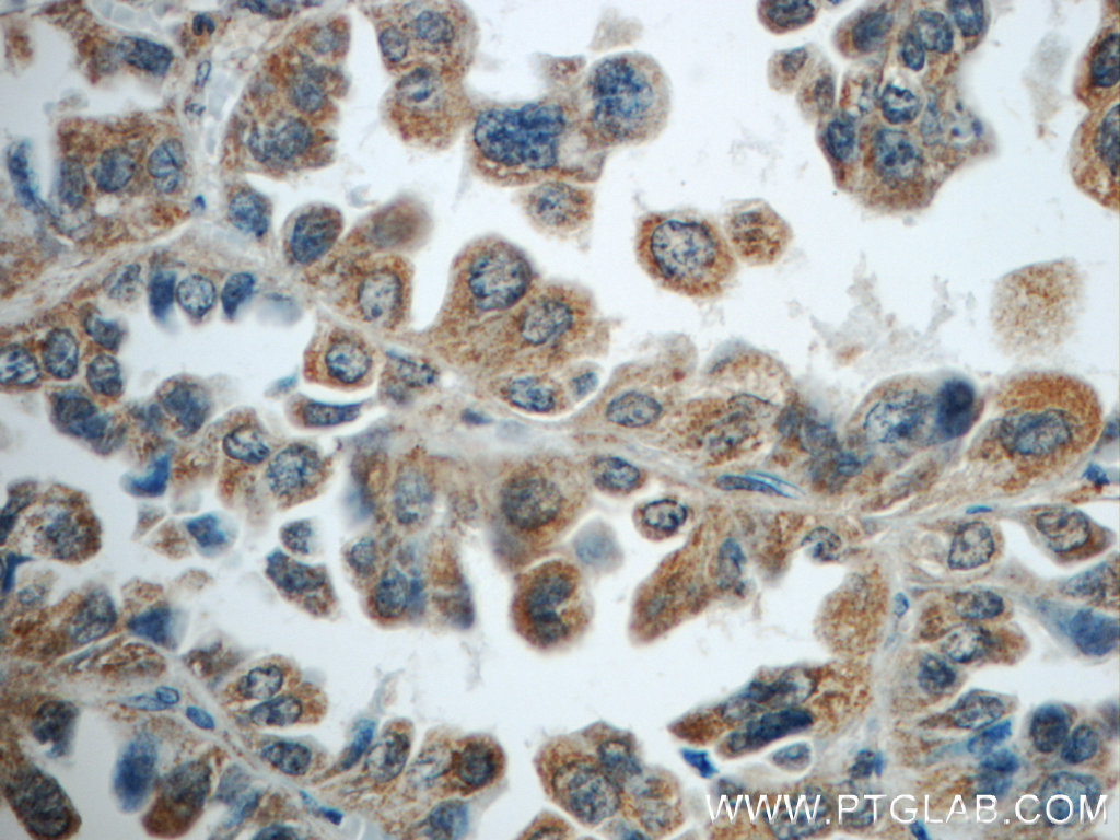 TNFAIP8 Polyclonal antibody