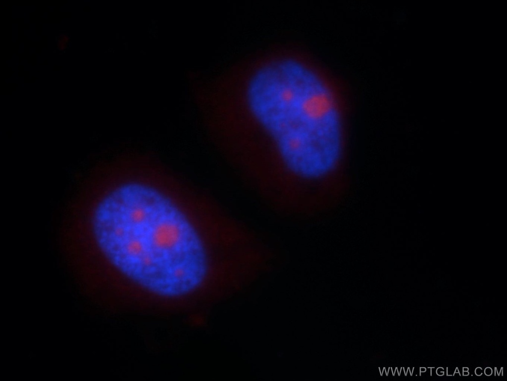 NHP2L1 Polyclonal antibody