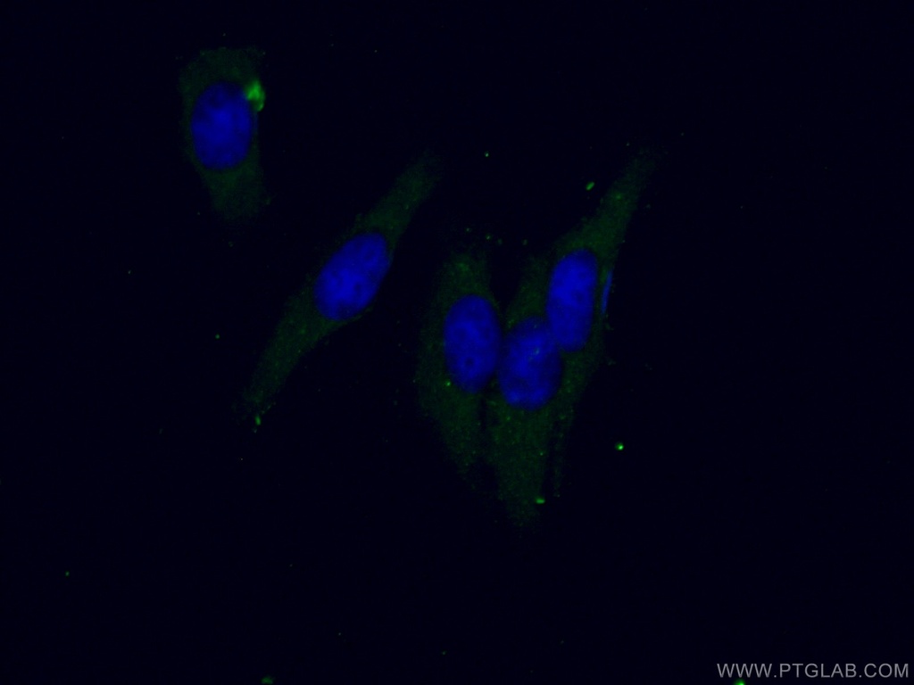 GLRX Polyclonal antibody