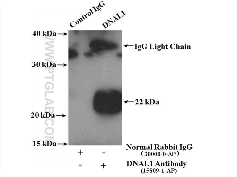 DNAL1 Polyclonal antibody