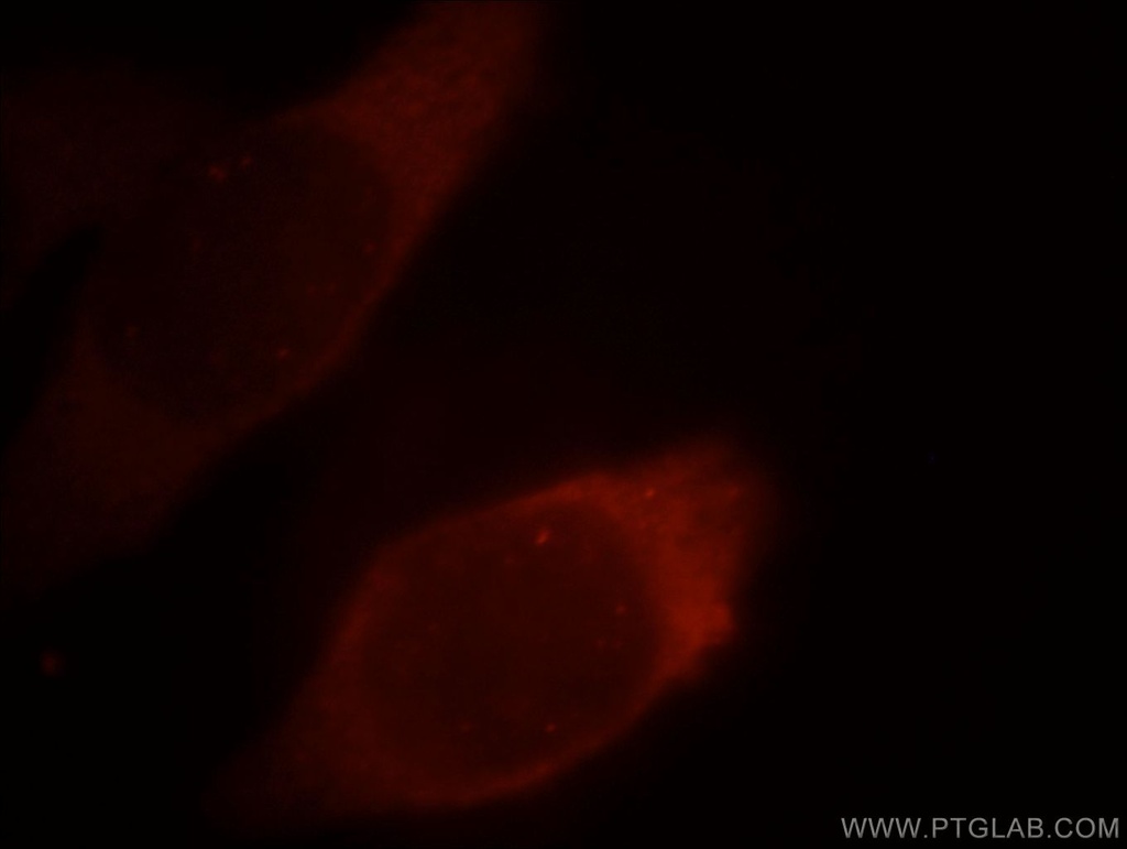 PKM2-specific Polyclonal antibody