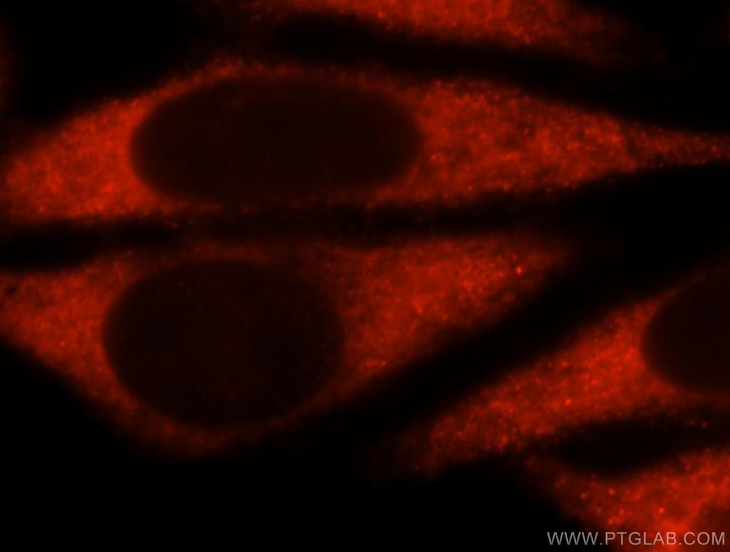 UBASH3A-Specific Polyclonal antibody