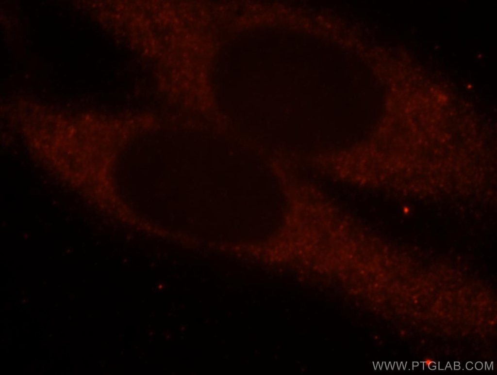 domain-I-of-FIZ-1 Polyclonal antibody