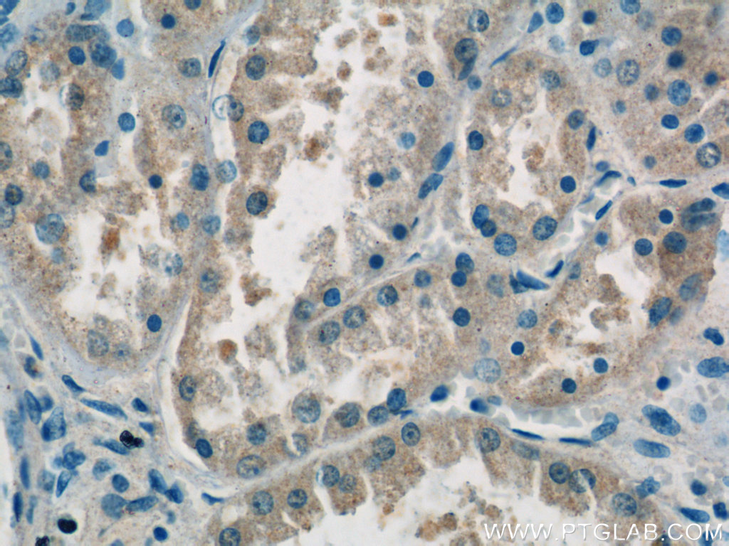 domain-II-of-FIZ1 Polyclonal antibody