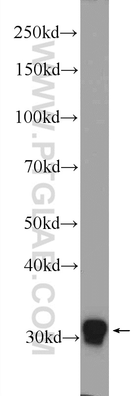 FOSL2 Polyclonal antibody