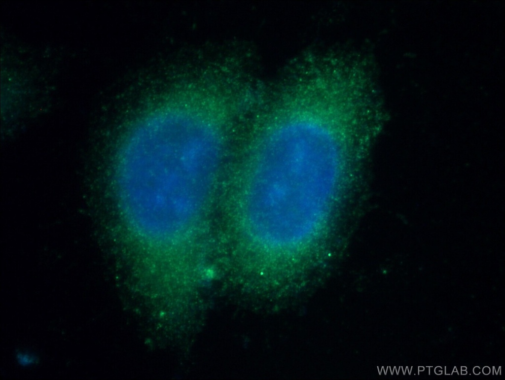 C4BPB Polyclonal antibody
