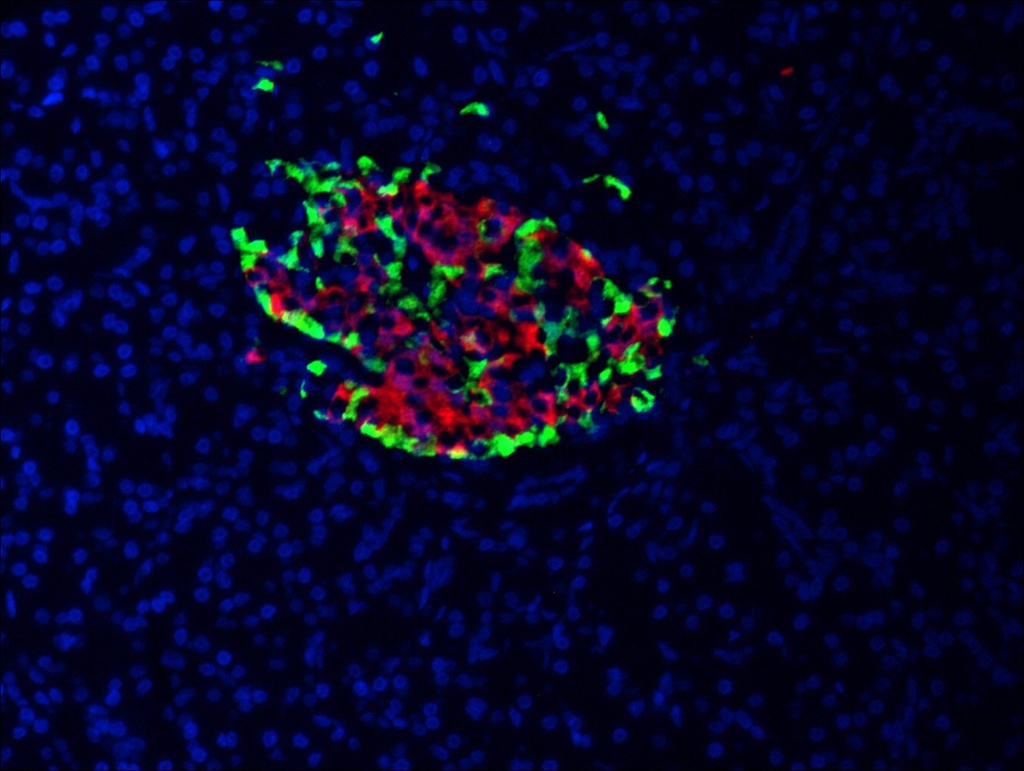 INS Polyclonal antibody