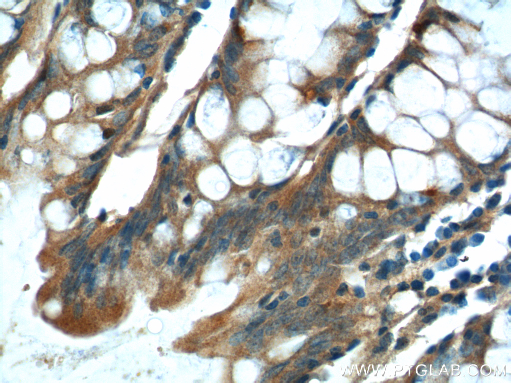 NDUFS4 Polyclonal antibody