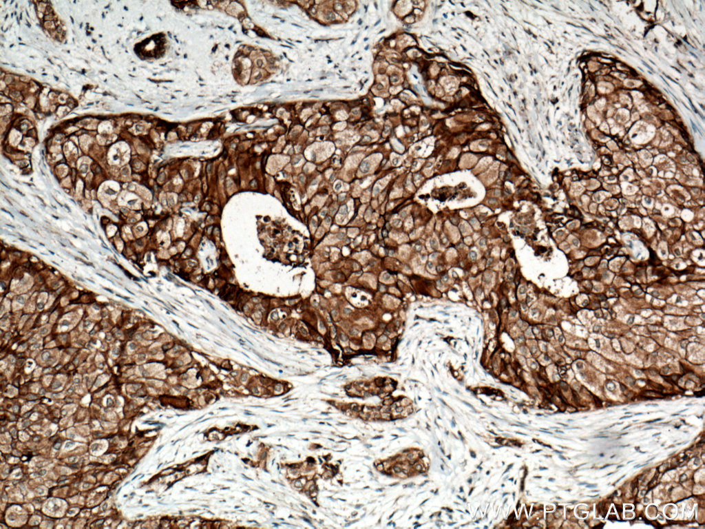FXYD3 Polyclonal antibody