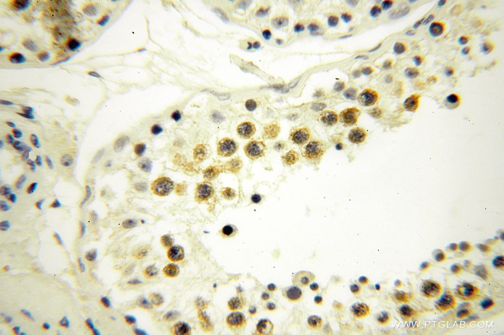 BTBD1 Polyclonal antibody