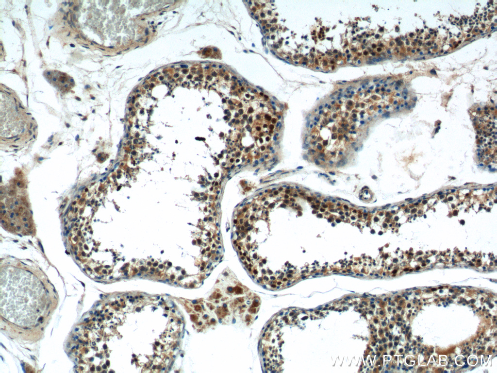 SSX4 Polyclonal antibody
