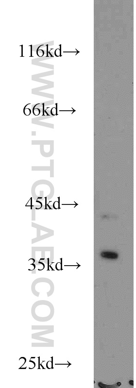 NECAP2 Polyclonal antibody