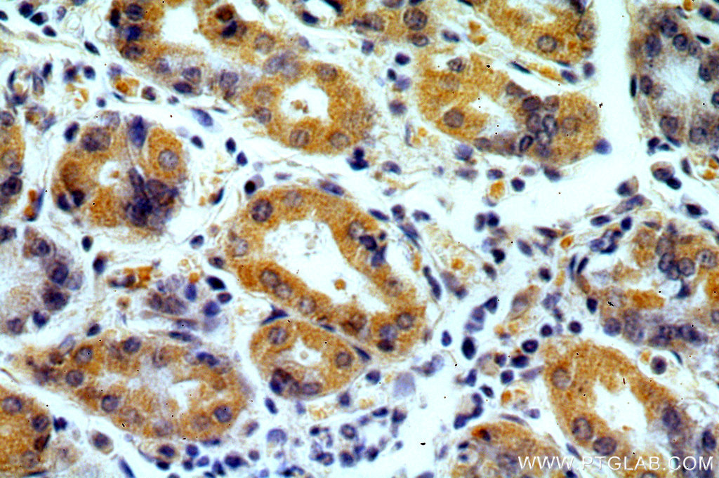 MRPS2 Polyclonal antibody