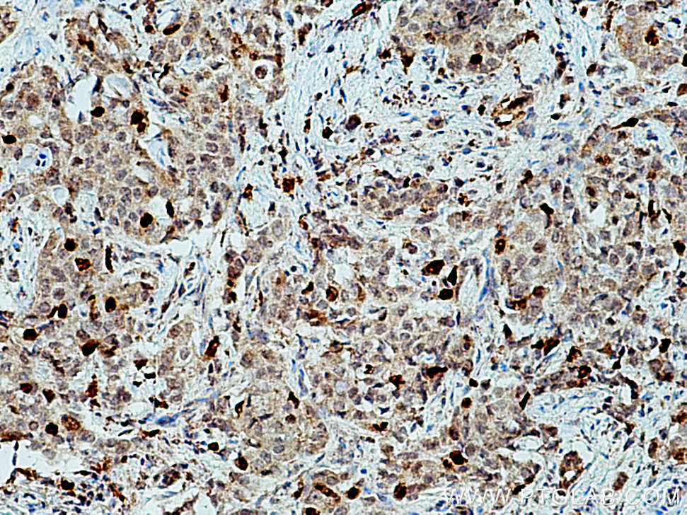 KIF20A Polyclonal antibody