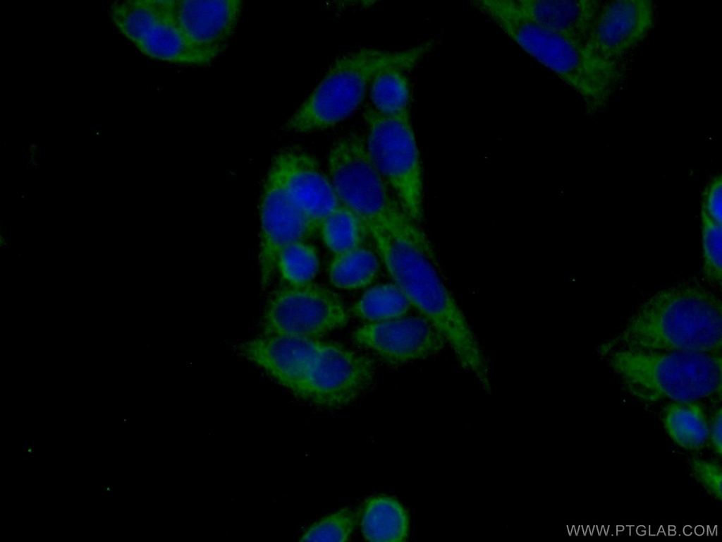 VPS26B Polyclonal antibody
