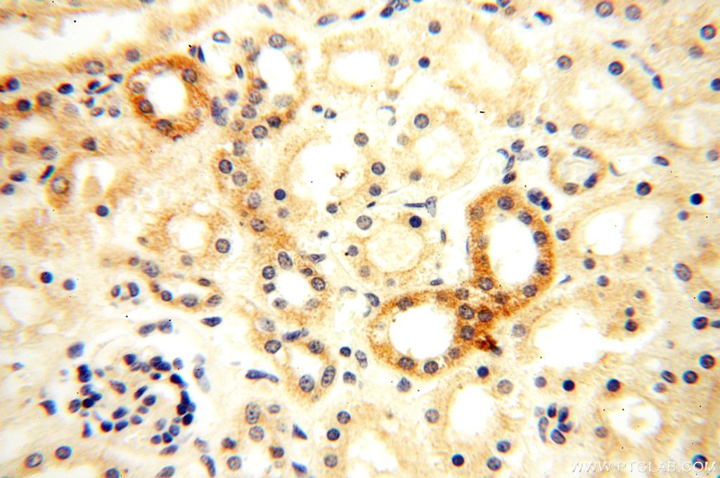 Semenogelin-1 Polyclonal antibody