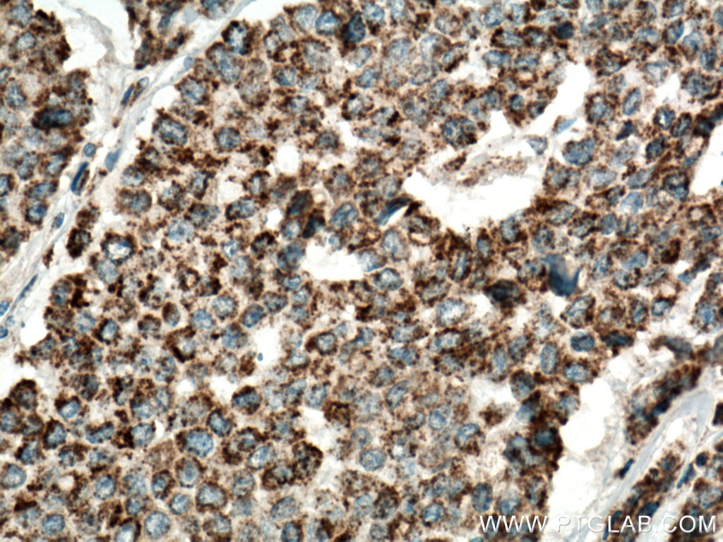 IDH2 Polyclonal antibody