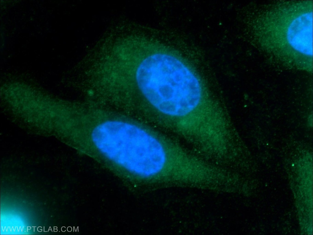 TIPE2 Polyclonal antibody