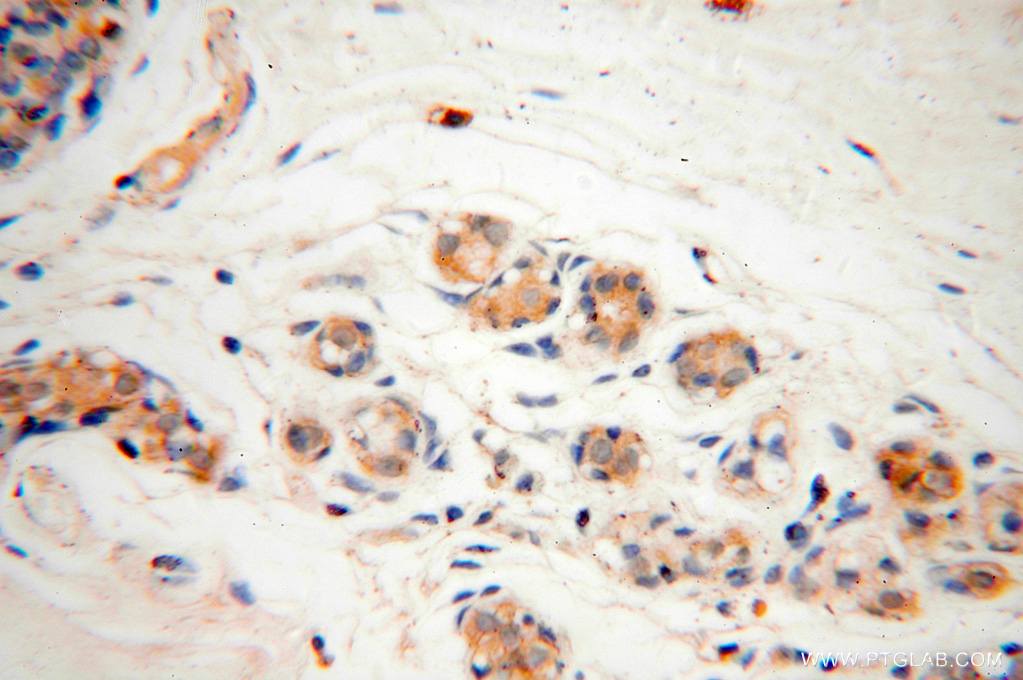CAPZA2 Polyclonal antibody